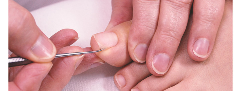 SPA pedikűr - a pedikűr fajtái